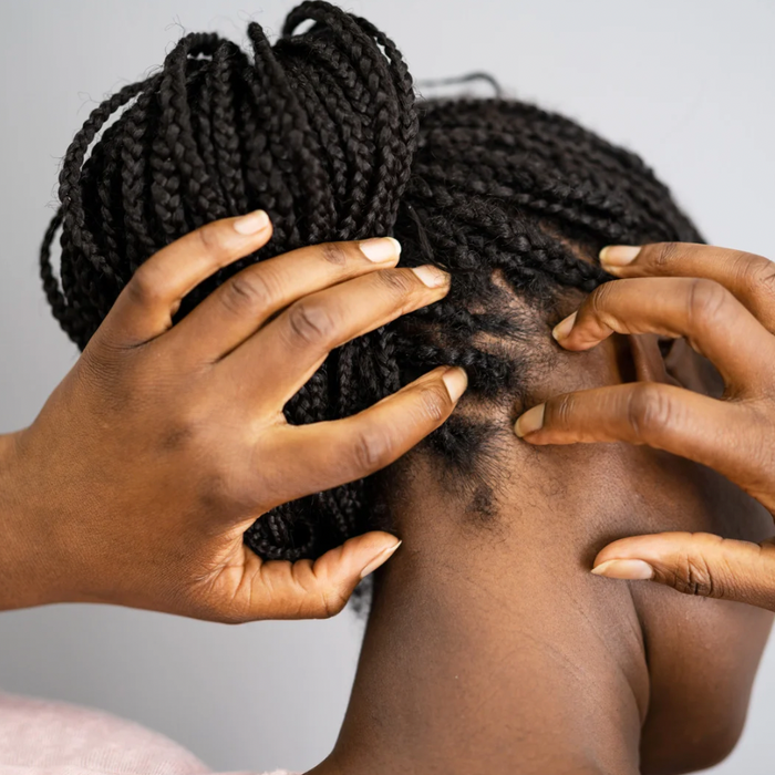 How to Tell if You Have Dry Scalp or Dandruff: Understanding the Differences, Causes, and Treatments